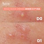 Creme-Intensivo-Avene-Cleanance-Comedomed-Peeling-40ml---4