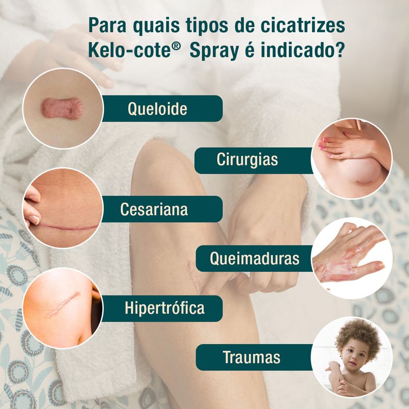 Kelo-cote-Spray-Farmoquimica-1-Unidade---4