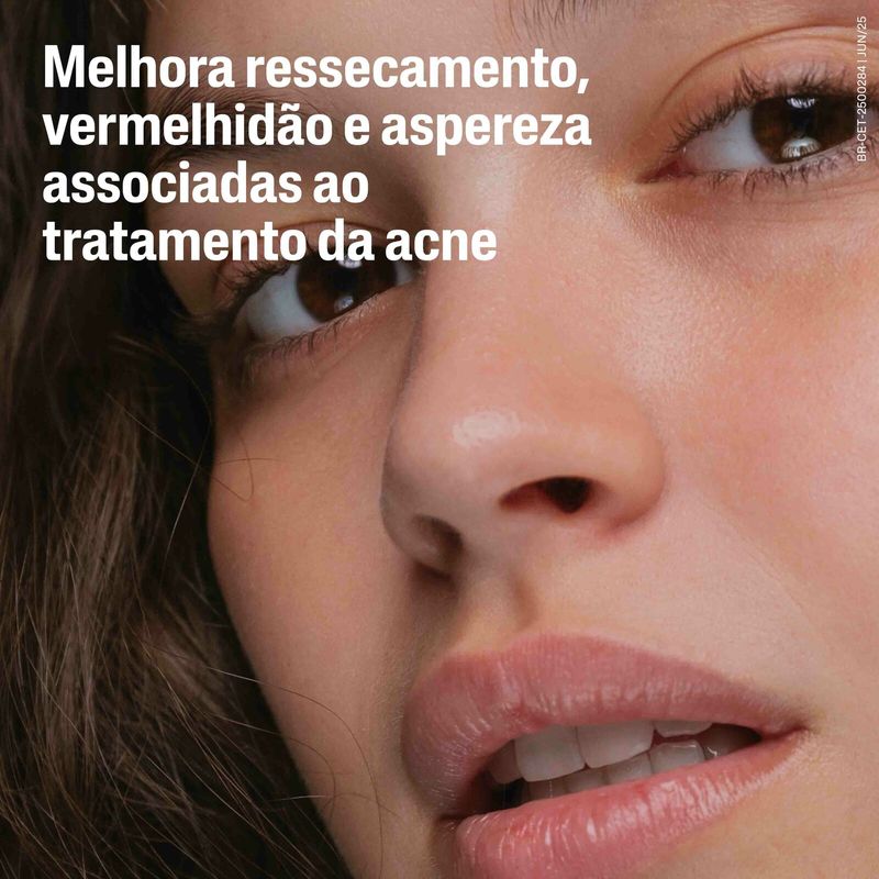 Locao-Hidratante-Facial-Cetaphil-Pro-AC-Dermacontrol-Pele-Oleosa-Fps30-118ml---3